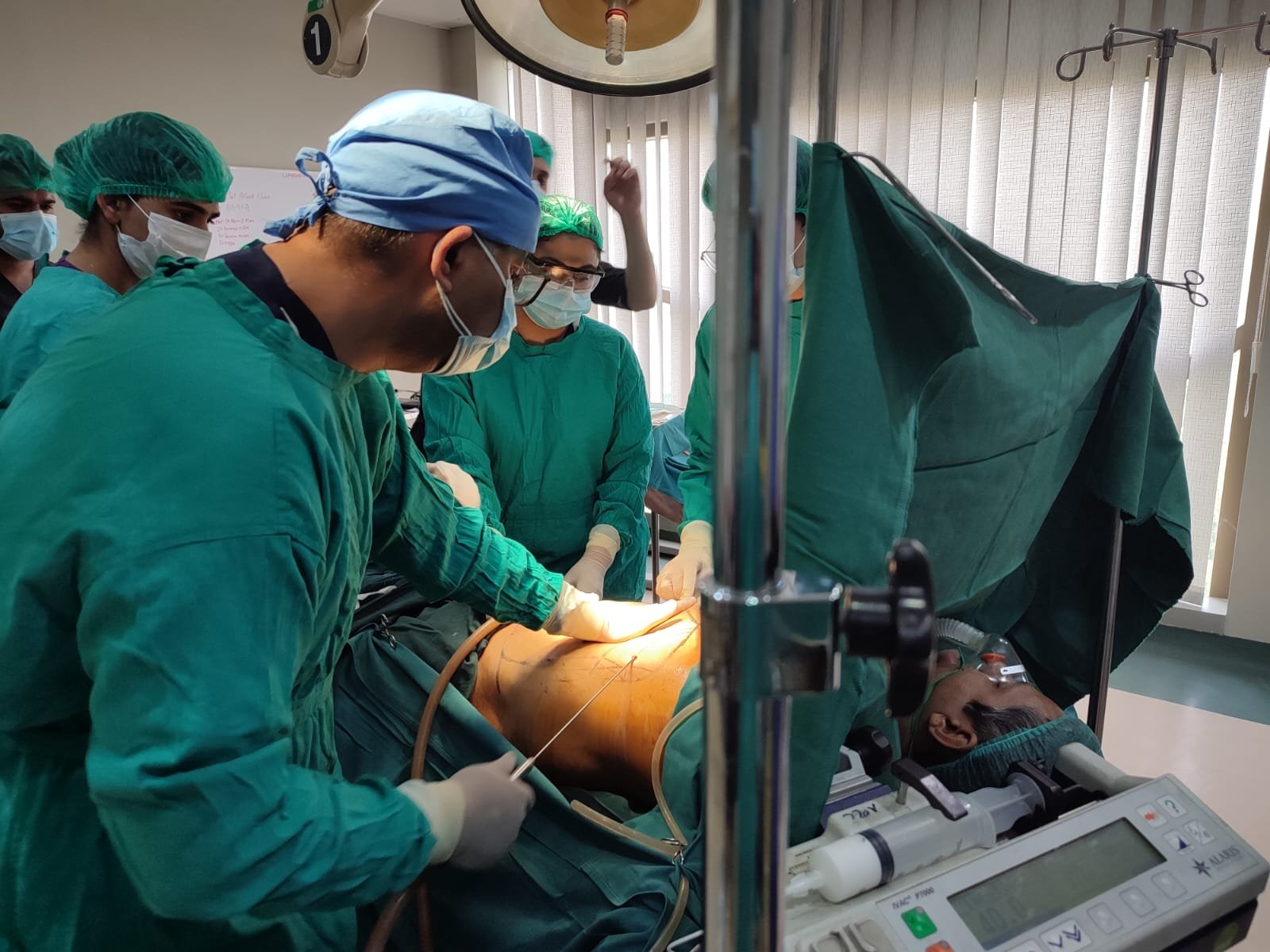 Liposuction Treatment